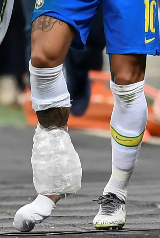 neymar injured2